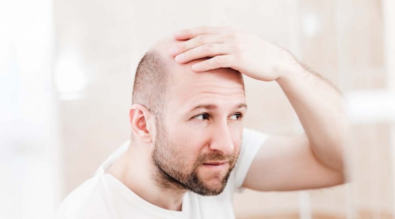 tricopigmentation